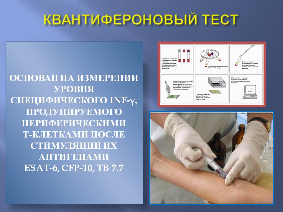 Купить справку квантифероновый тест в Москве